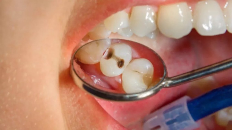 Soins préventifs et curatifs
